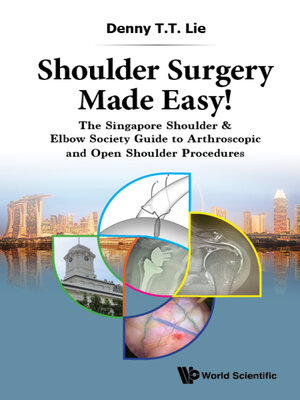 cover image of Shoulder Surgery Made Easy!